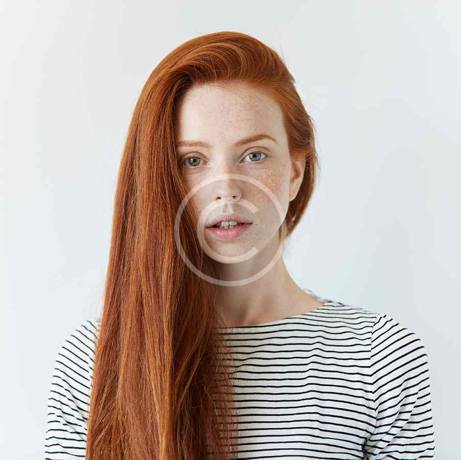 Young woman with long red hair and freckles wearing a striped shirt.